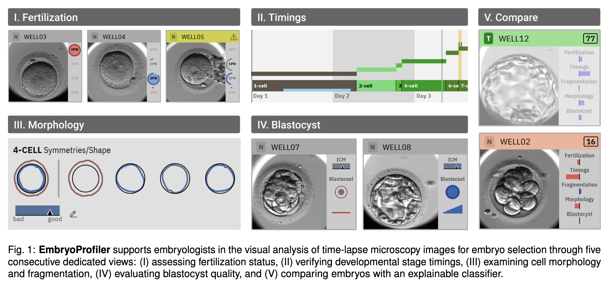 embryoprofiler-interface